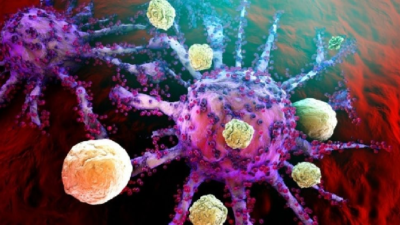 Kematian Paling Mengerikan Di Dunia Disebabkan Oleh Penyakit Kanker, Begini Penjelasannya